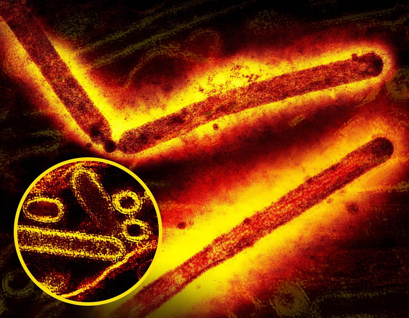 Researchers across country warn of uptick in deadly flu complication affecting young children
