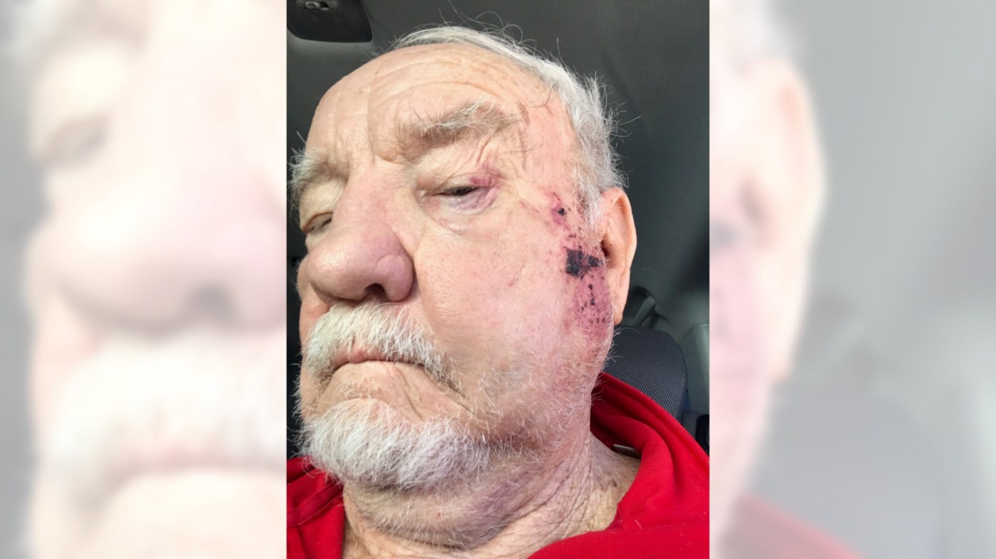 Man charged in beating of 82-year-old at California Elks Lodge pleads no contest