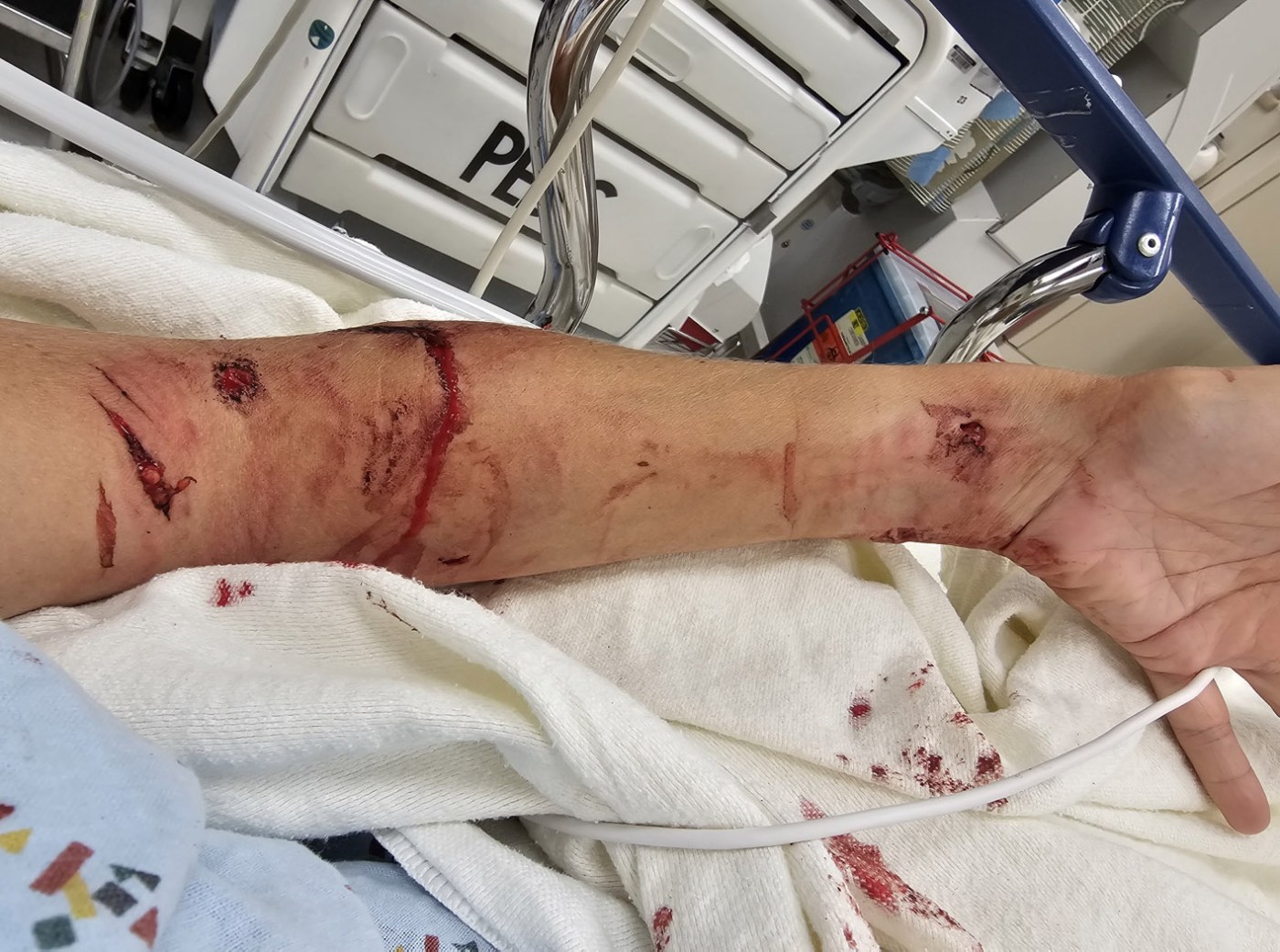 Dog mauling at California animal shelter sparks negligence suit from volunteer