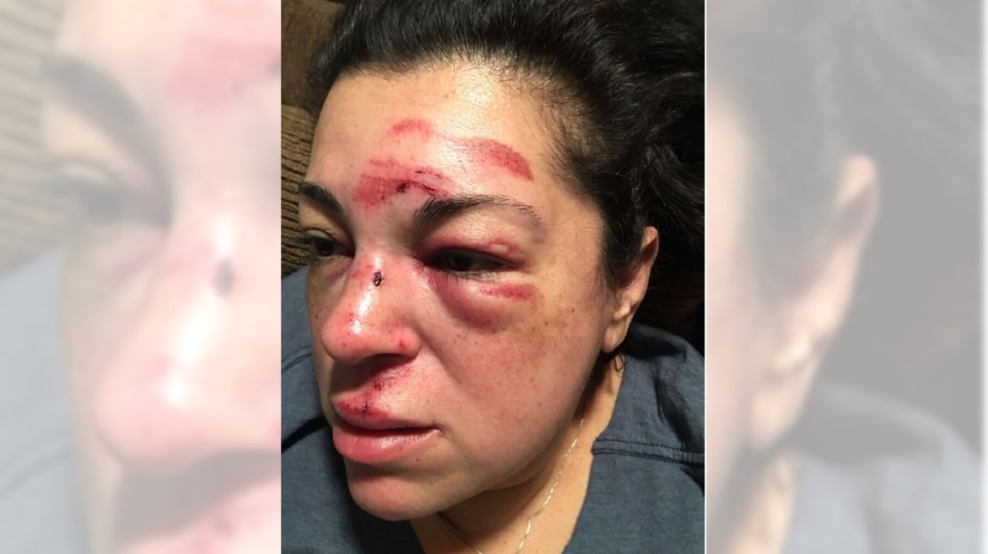 California teacher wins $7.5 million in settlement over fall on sidewalk